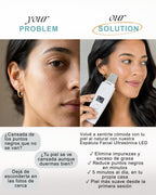 Skin Scrubber LED - Limpiador Facial Ultrasónico Uruguay