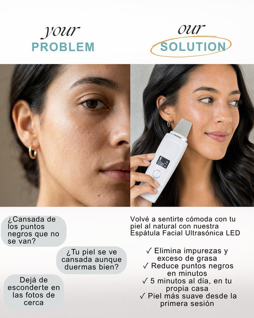 Skin Scrubber LED - Limpiador Facial Ultrasónico Uruguay